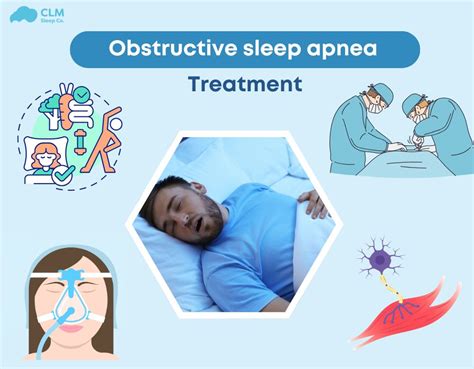 Sleep Apnea: Uncovering Comprehensive Treatment Options