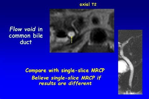 Slide Interpretation from the MRCP Kindle Editon