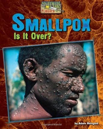 Smallpox: A Historical Nightmare