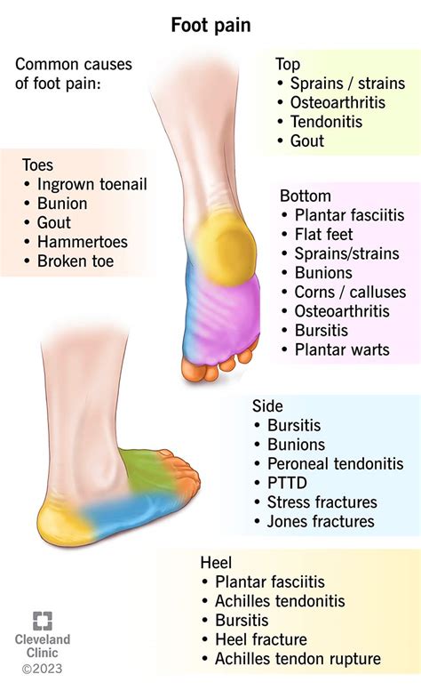 Sole of Foot Hurts When Walking: 10,000 Steps to Uncovering the Cause