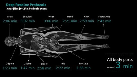 Spark Performance: Secrets Revealed for Unrivaled Speed and Efficiency