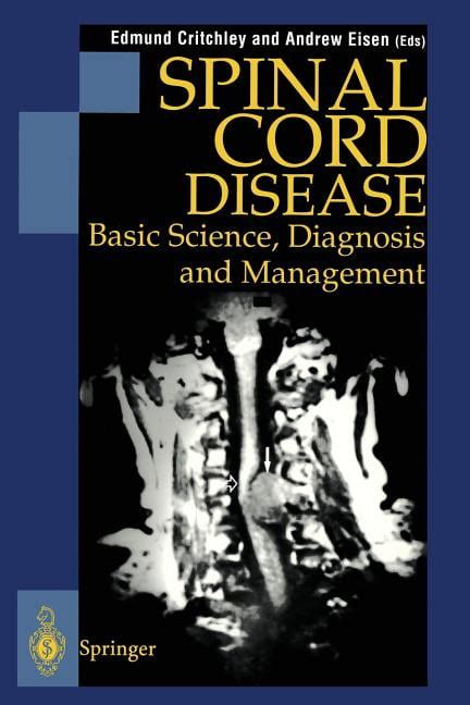 Spinal Cord Disease Basic Science, Diagnosis and Management Epub