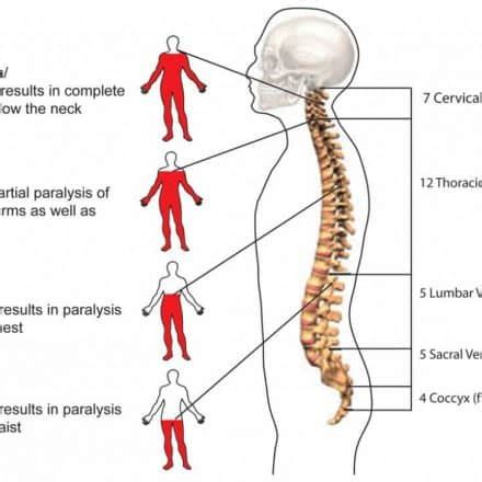 Spinal Cord Injury Progress Reader