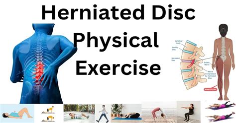 Spinal Disc Herniation Exercises: A Comprehensive Guide to Recovery