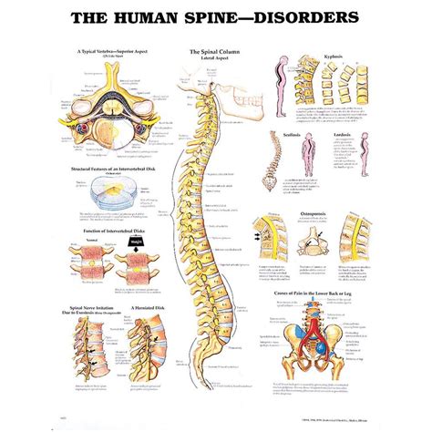 Spinal Disorders For Beginners: The Oswestry Spine Primer Ebook Reader