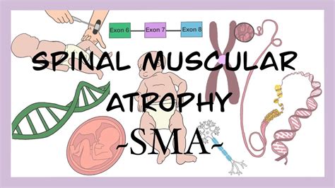 Spinal Muscular Atrophy in Singapore: Insights and Support