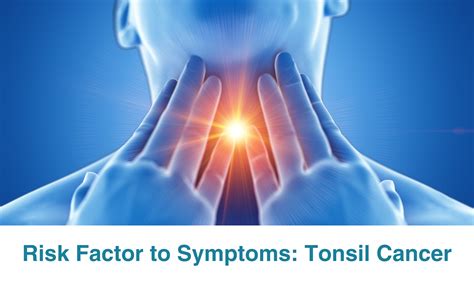 Squamous Cell Carcinoma of the Tonsil: A Comprehensive Guide