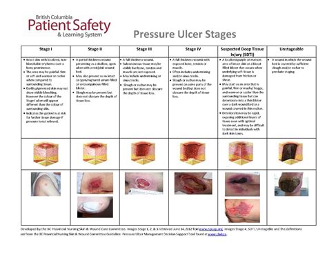 Stage 3 Pressure Ulcer Pictures: A Visual Guide to Diagnosis and Treatment