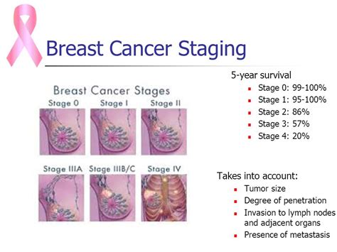 Stage 4 Breast Cancer Symptoms of Dying: A Comprehensive Guide