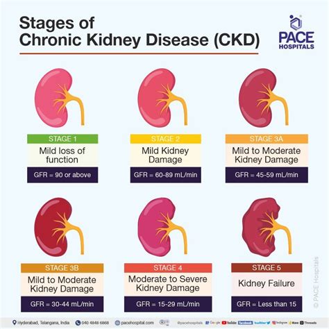 Stage 4 Kidney Function: A Comprehensive Guide to Understanding Your Health