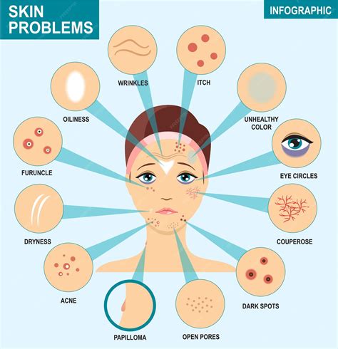 Starrflesh: A Comprehensive Guide to the Skin Condition