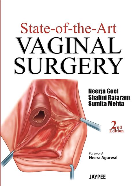 State-of-the-Art Vaginal Surgery Epub