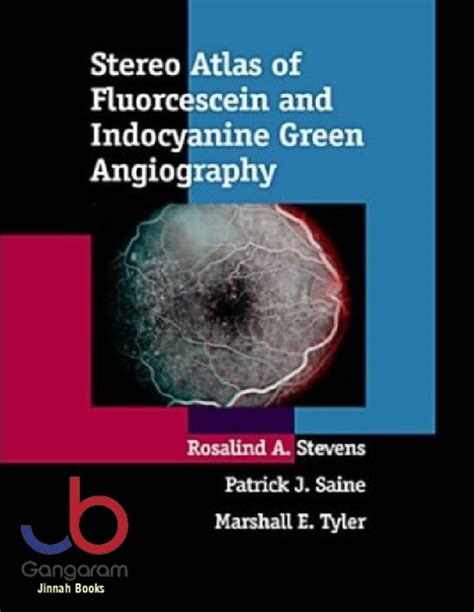 Stereo Atlas of Fluorescein and Indocyanine Green Angiography Epub