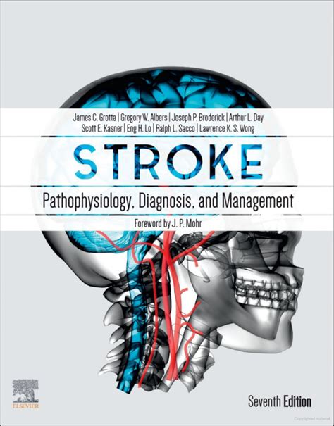 Stroke Pathophysiology, Diagnosis and Management Kindle Editon