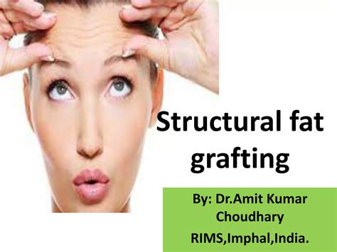 Structural Fat Grafting Kindle Editon