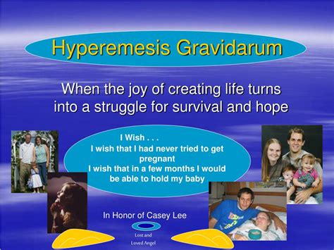 Struggling to Create a Captivating Hyperemesis Gravidarum Presentation? Here's How a Pre-Made PPT Can Save the Day!