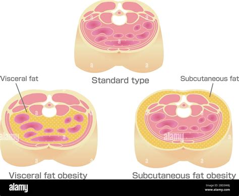 Subcutaneous fat