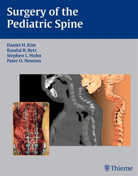 Surgery of the Pediatric Spine Doc