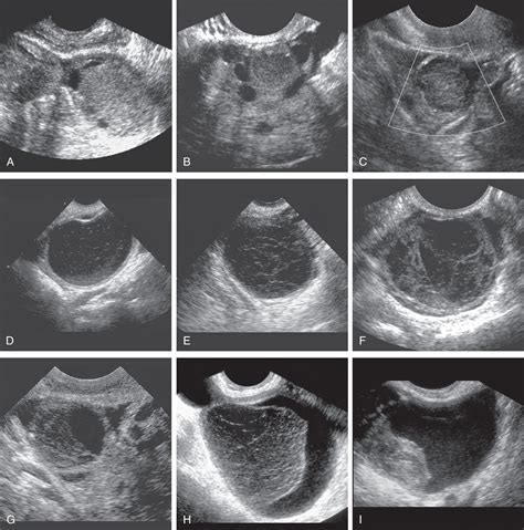 Surgical Pathology of the Ovaries Reader