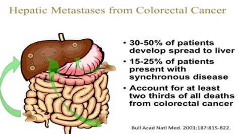 Surgical Treatment of Hepatic Metastases of Colorectal Diseases Report of the 94th French Congress Epub