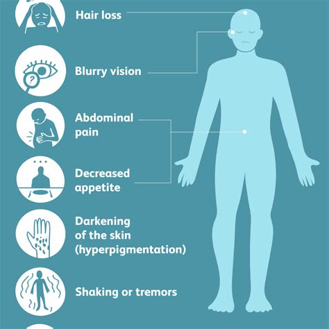 Symptoms of Addison's Disease