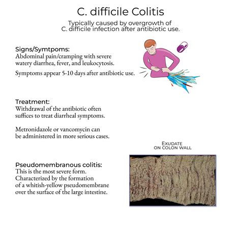 Symptoms of C. difficile Colitis