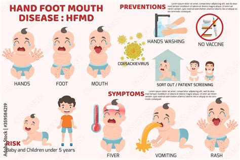 Symptoms of HFMD: