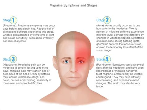 Symptoms of Right-Sided Migraines