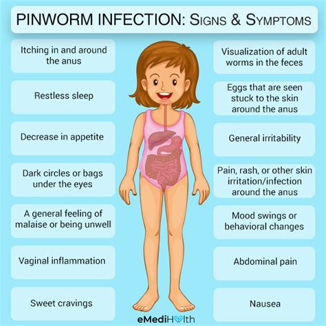 Symptoms of pinworms include: