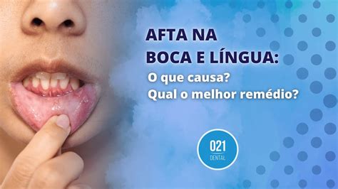 Título: Será que o Zyn causa aftas na boca?