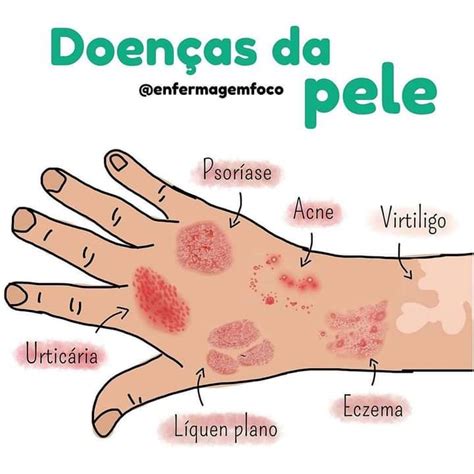 Tabela 1: Estatísticas sobre Doenças da Pele