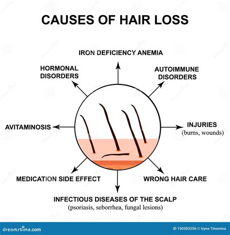 Table 1: Causes of Hair Loss