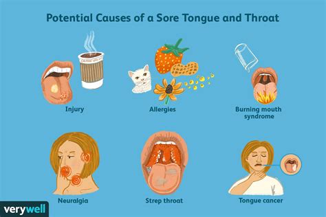 Table 1: Common Causes of Sore Throats