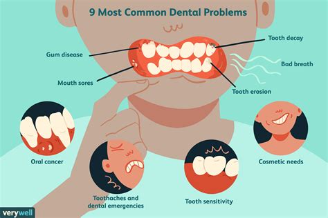 Table 1: Common Dental Problems and Their Prevalence