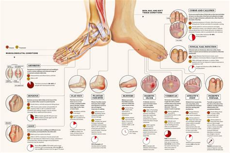 Table 1: Common Foot Problems