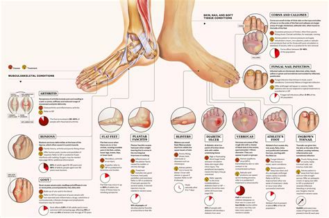 Table 1: Common Foot Problems and Their Prevalence