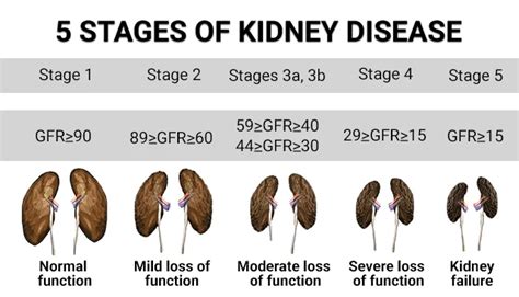 Table 1: Life Expectancy of People with Kidney Failure