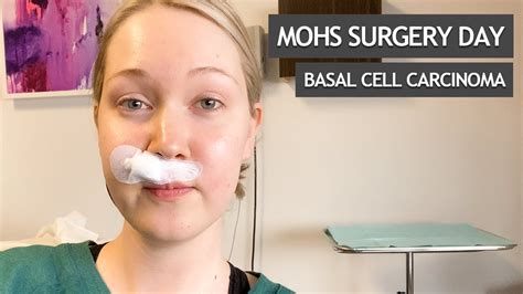 Table 1: MOH Surgical Operation Fees for Basal Cell Carcinoma