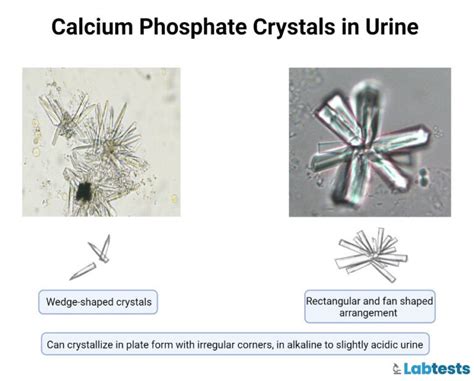 Table 1: Types of Eye Crystals