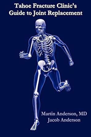 Tahoe Fracture Clinics Guide to Joint Replacement Ebook Epub