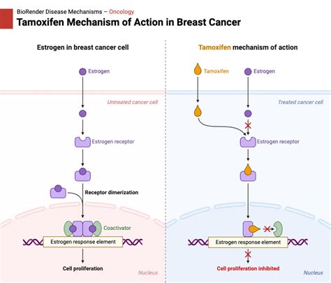 Tamoxifen and Breast Cancer Kindle Editon