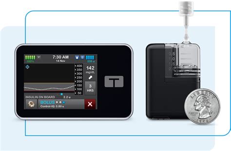 Tandem Diabetes Care Inc.: A Leader in Insulin Delivery Innovation