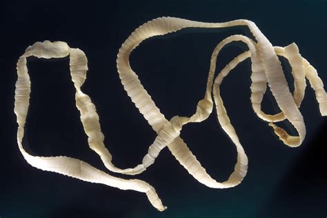 Tapeworms in the United States