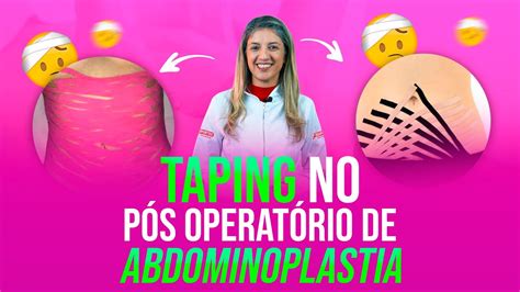 Taping Pós-Abdominoplastia: Tudo o que Você Precisa Saber