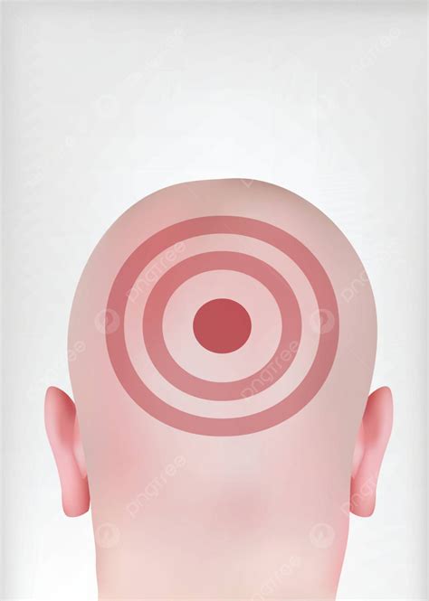 Target the Head: