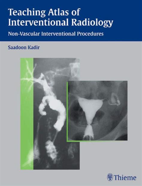 Teaching Atlas of Interventional Radiology Non-Vascular Interventional Procedures Reader