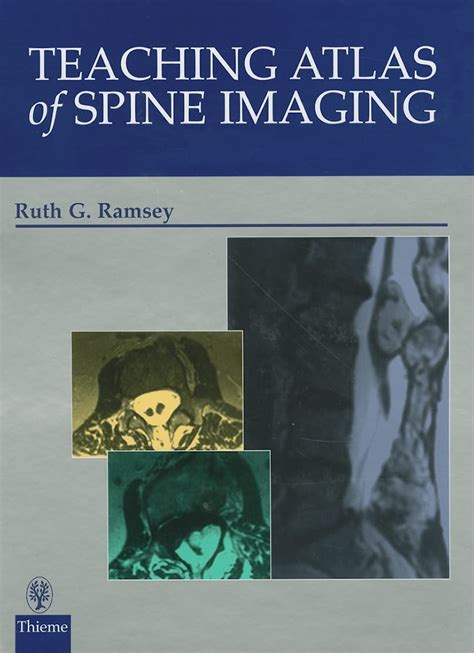 Teaching Atlas of Spine Imaging 1st Edition Kindle Editon