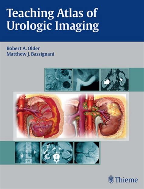 Teaching Atlas of Urologic Imaging Kindle Editon