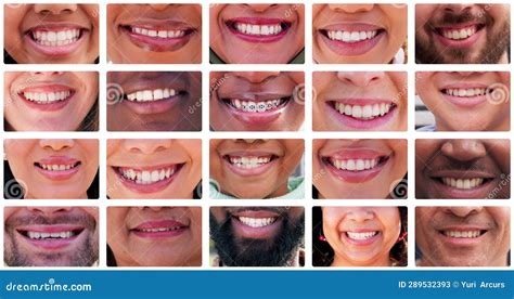 Teeth: A Hallmark of Diversity