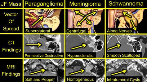 Temporal Bone Imaging PDF